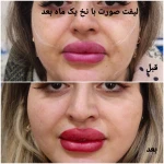 کلینیک زیبایی و لیزر مو گندم