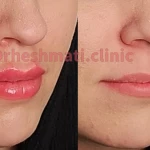 کلینیک پوست مو زیبایی دکتر حشمتی