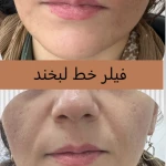 کلینیک پوست مو لیزر لاغری زیباریس