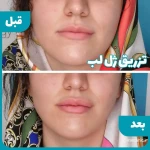 کلینیک تخصصی پوست، مو ،زیبایی ایران