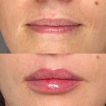 مطب پوست، مو،زیبایی و لیزر دکتر ستارپور