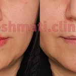 تصویر کلینیک پوست مو زیبایی دکتر حشمتی