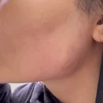 مرکز لیزرو پوست و طب سوزنی الماس تابان