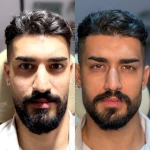 مرکز لیزر و زیبایی هانیسا