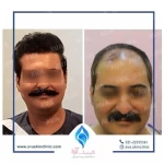 لوگوی کلینیک پوست و مو آوا