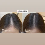 کلینیک زیبایی و مرکز لیزر سنسیا