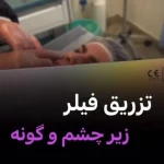 نمونه کار کلینیک پوست مو زیبایی دکتر جعفری نیا