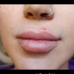 دکتر محمد امید بهترین دکتر زیبایی کانتور