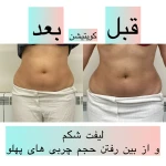 نمونه کار کلینیک زیبایی و لیزر ژاله