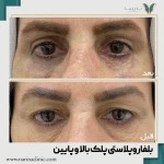 کلینیک پوست ، مو و لیزر نارینا