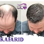 کلینیک پوست و مو نیک آفرید