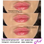  کلینیک لیزر , زیبایی و لاغری نوران