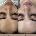  مرکز تخصصی پاکسازی پوست بنوشه