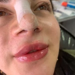 کلینیک زیبایی دکتر فاطمه کوچالی