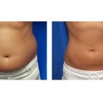 کلینیک لیزر ،ژل ،بوتاکس و لاغری ویتالایف