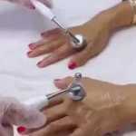 فیشال تخصصی و درمان جوش ولک Zhikan