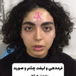 كلينيك زیبایی زهرا کیا