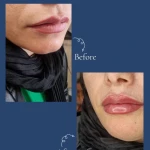 کلینیک زیبایی و مرکز لیزر ماری اسکین