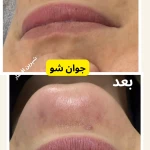  آکادمی تخصصی پوست و مو شیرین افشار