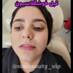 کلینیک لیزر لاغری فشیال پلاژن فیلربوتاکس