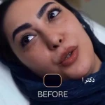 کلینیک زیبایی پوست و لیزر بلاریا
