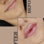 کلینیک زیبایی درناز (تخفیف ویژه لیزر)