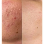 خدمات فوق تخصصی پوست مژگان صالحی
