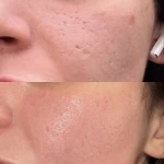 مرکز لیزر کلینیک زیبایی دنیای نقره ای