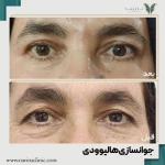 کلینیک پوست ، مو و لیزر نارینا