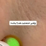 کلینیک لیزر و پوست و مو سابرینا شعبه نارمک