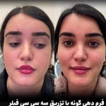 نمونه کار مرکز پوست ،مو و زیبایی دکتر ستارپور