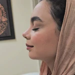 تصویر جراحی  زیبایی بینی  و صورت نئوفیس