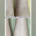 کلینیک زیبایی و لیزر موهای زائد باران