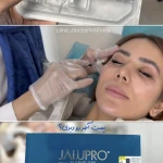 نمونه کار کلینیک زیبایی دکتر کاشانی