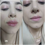 کلینیک زیبایی و لیزر مو گندم