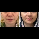 مطب زیبایی دکتر بهمنی