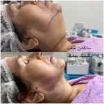 کلینیک تخصصی پوست و زیبایی بهشاد