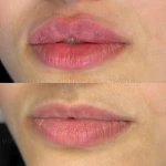 مرکز لیزر و زیبایی هانیسا