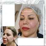 مرکز زیبایی و لیزر دکتر مریم نوکنده