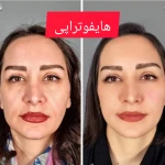 مرکز زیبایی، لیزر و تناسب اندام لبخند