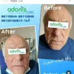 کلینیک پوست مو زیبایی و لیزر آدونیس