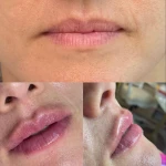 تصویر کلینیک زیبایی و لیزر ژاله