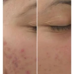 تصویر خدمات فوق تخصصی پوست مژگان صالحی