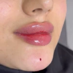 تصویر خانه لیزر فیلر و بوتاکس ثنا