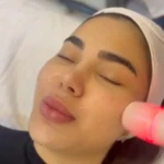 تصویر خدمات تخصصی فیشال و پاکسازی پوست حفظی