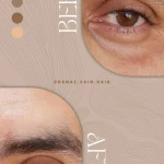  کلینیک زیبایی درناز (تخفیف ویژه لیزر)