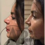 کلینیک زیبایی و مرکز لیزر موی زائد آریسا