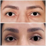 جراحی  زیبایی بینی  و صورت نئوفیس
