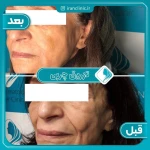نمونه کار کلینیک تخصصی پوست، مو ،زیبایی ایران
