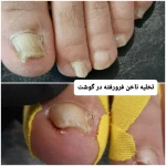 نمونه کار پدیکور و پودولوژیSD